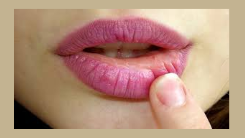 রোদে পুড়েছে ঠোঁট: প্রাথমিক যত্ন ও প্রতিরোধের সহজ উপায়