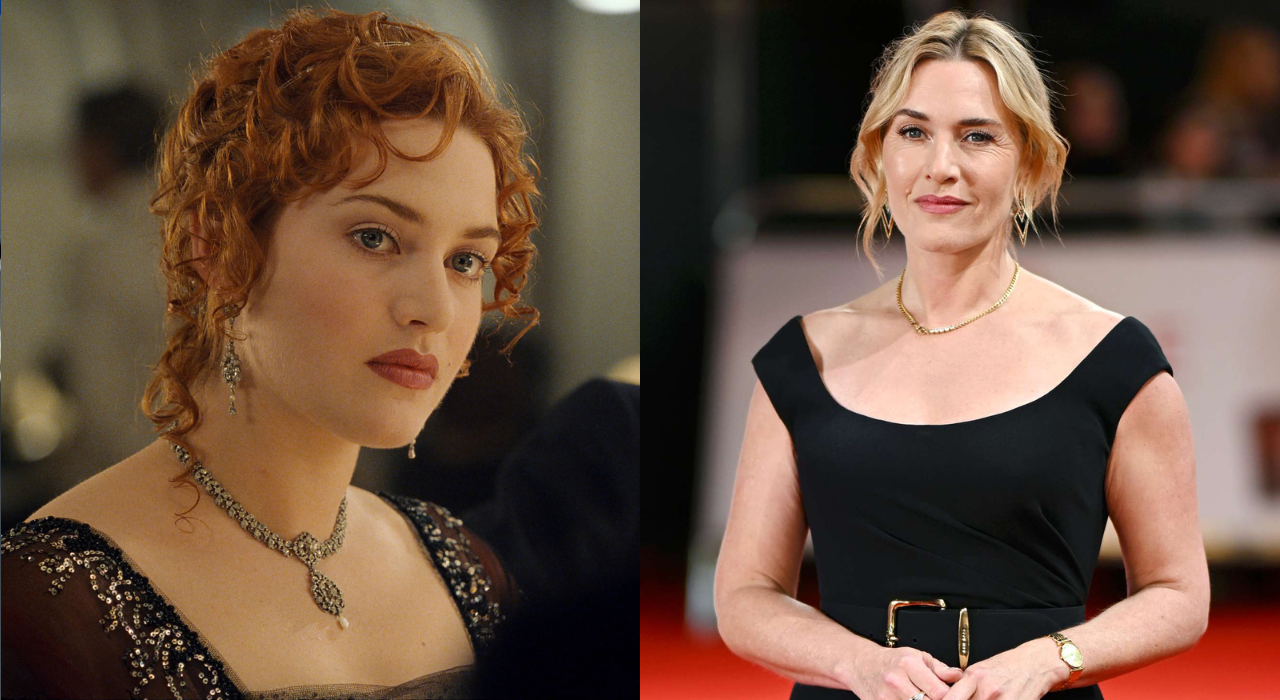 প্লাস্টিক সার্জারি নিয়ে কঠোর সমালোচনা টাইটানিক অভিনেত্রীর